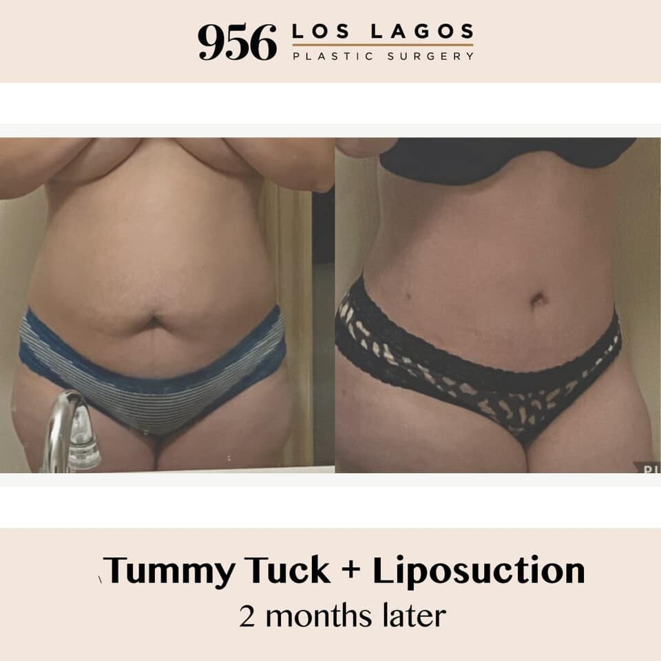 Clinic Results Gallery